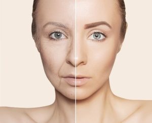 علت افتادگی پوست صورت چیست و روش‌های درمان آن کدامند؟