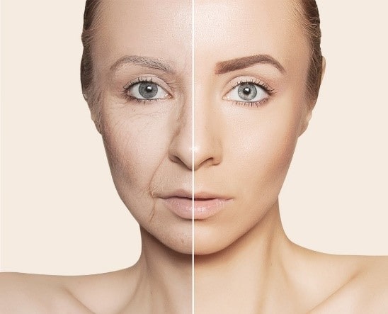 علت افتادگی پوست صورت چیست و روش‌های درمان آن کدامند؟